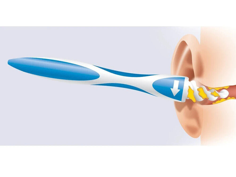 Schmerzfrei Ohrenschmalz Entferner Set / Innovations-Ohrreiniger + 15 Softtips