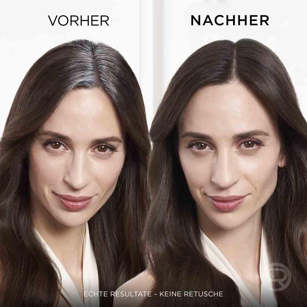 L'Oréal Paris Magic Retouch Ansatz Kaschierspray Schwarz 75ml