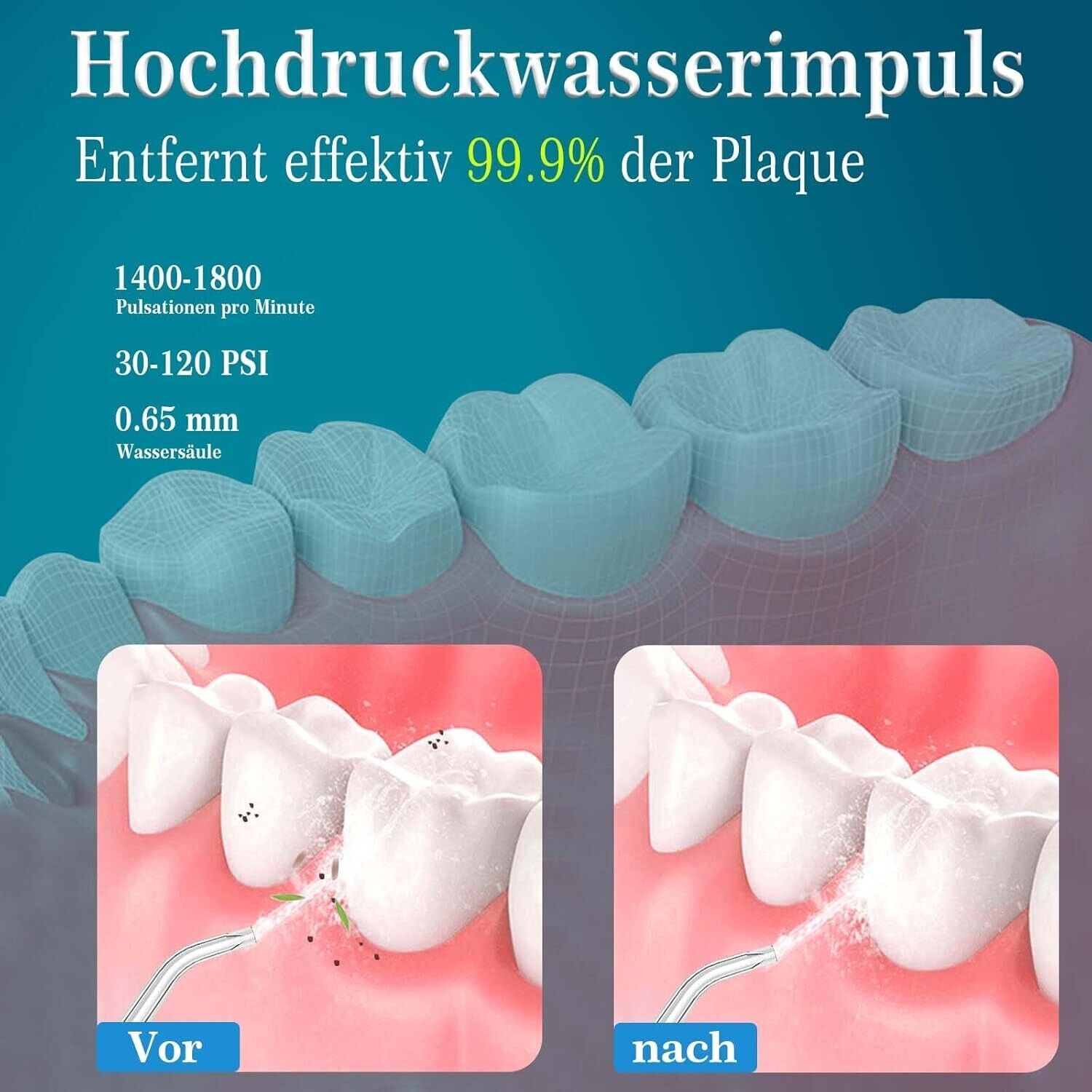 Munddusche Kabellos Elektrische Zahndusche Wasser Zahnreiniger, Oral Irrigator